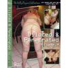 Dilated & Penetrated - Volume A