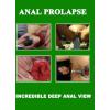 Anal Prolapse - Incredible deep anal View