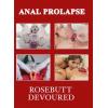 Anal Prolapse - Rosebutt Devoured