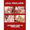 Anal Prolapse - Learning how to Prolapse