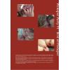 Prolapse Party #4 - Best of Prolapse